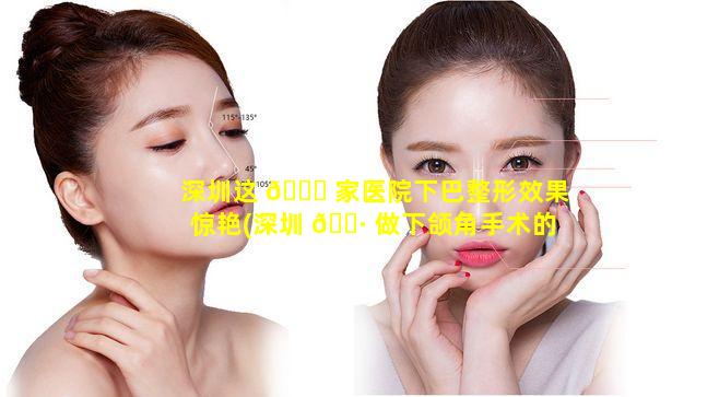 深圳这 🐛 家医院下巴整形效果惊艳(深圳 🌷 做下颌角手术的医院)